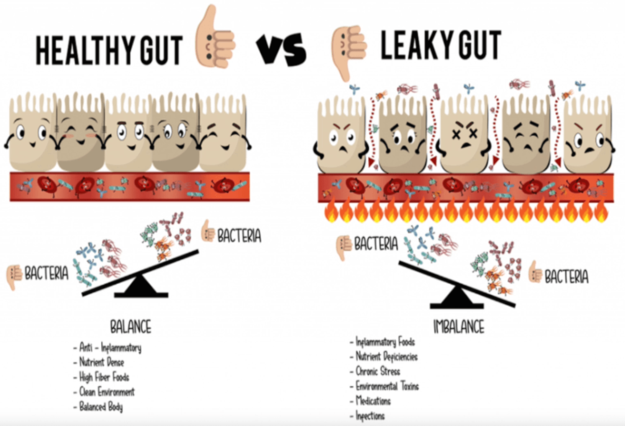 Health Gut Vs Leaky Gut